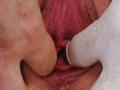 Busty Jenny extreme pussy gaping on gyno chai