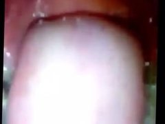 Girl Swallows 41 Marbles