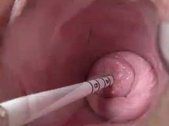 masturbating in the uterus