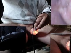 inflated light foreskin with 3 cam and endoscope inside